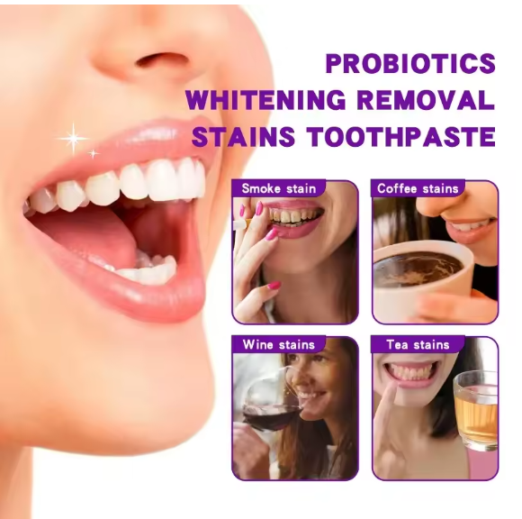 Toothpaste for Teeth Whitening (30ml)